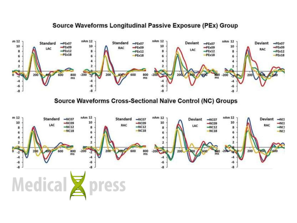 Medical Xpress Infant exposure to brief auditory cues can support